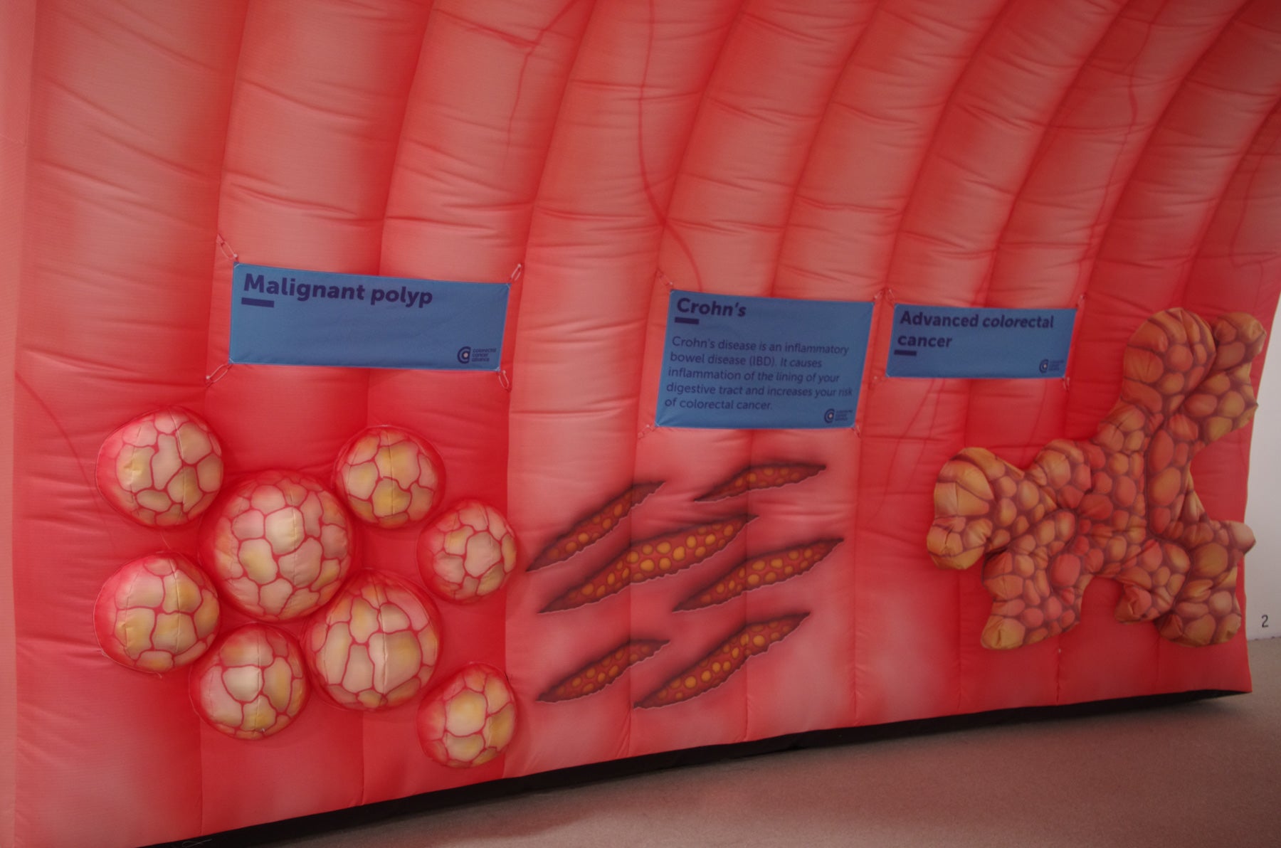 Small Inflatable Colon Medium Inflatable Colon - Rental – The Alliance Shop