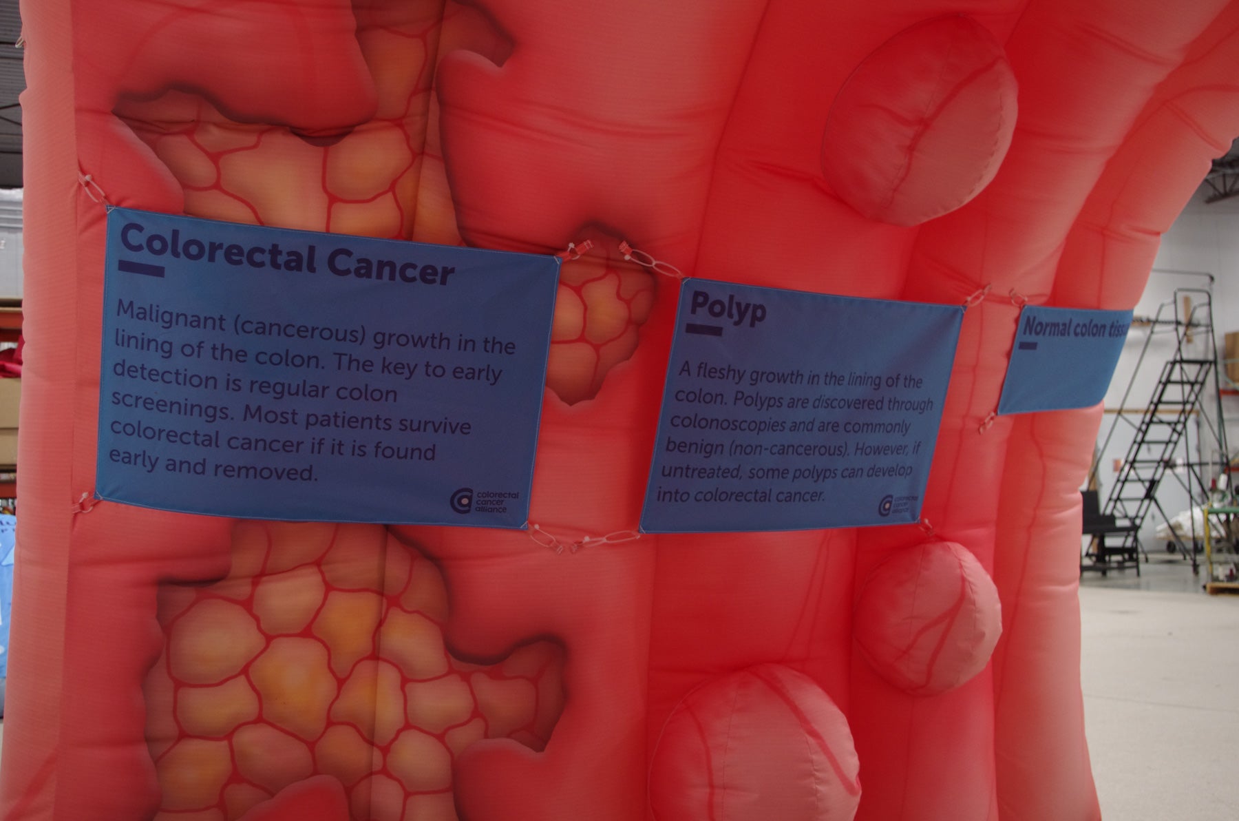 Medium Inflatable Colon – The Alliance Shop